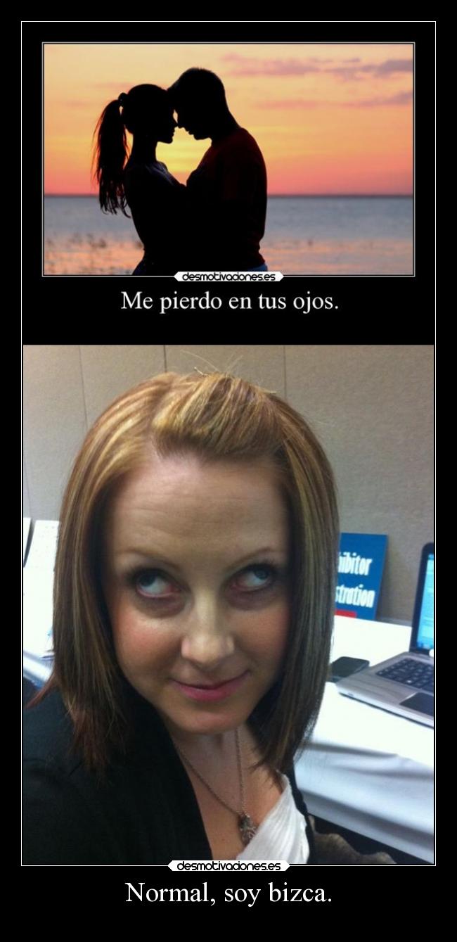 Normal, soy bizca. -