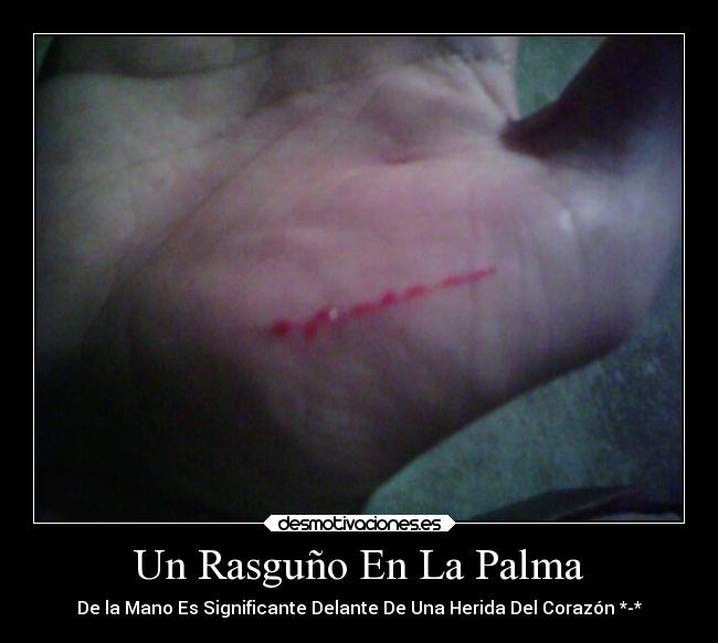 Un Rasguño En La Palma - De la Mano Es Significante Delante De Una Herida Del Corazón *-*