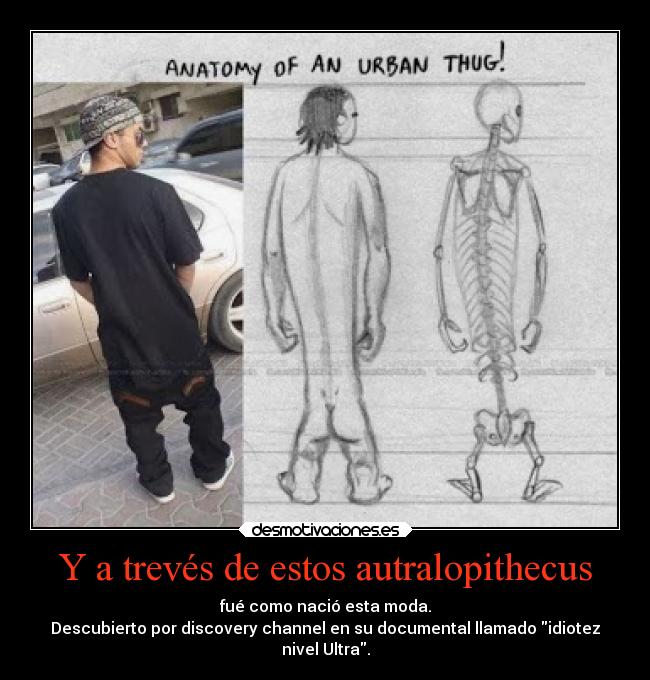 Y a trevés de estos autralopithecus - fué como nació esta moda.
Descubierto por discovery channel en su documental llamado idiotez
nivel Ultra.