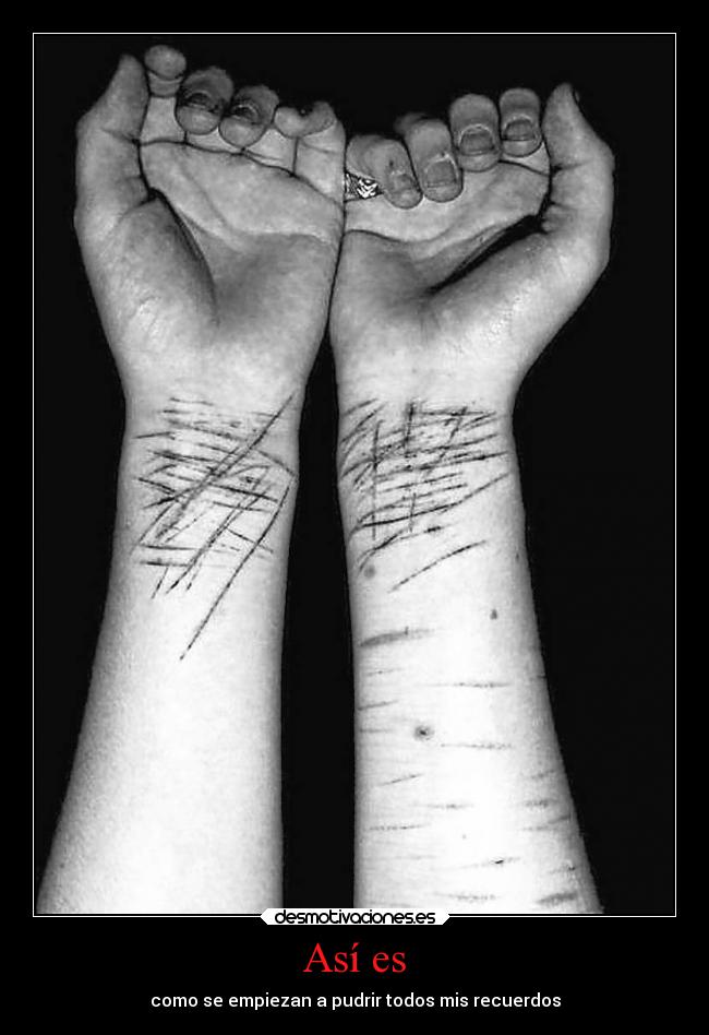Así es - como se empiezan a pudrir todos mis recuerdos