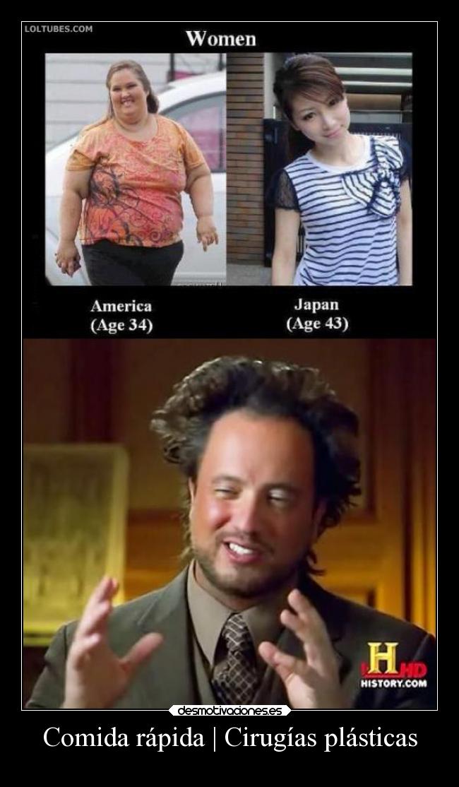 Comida rápida | Cirugías plásticas - 