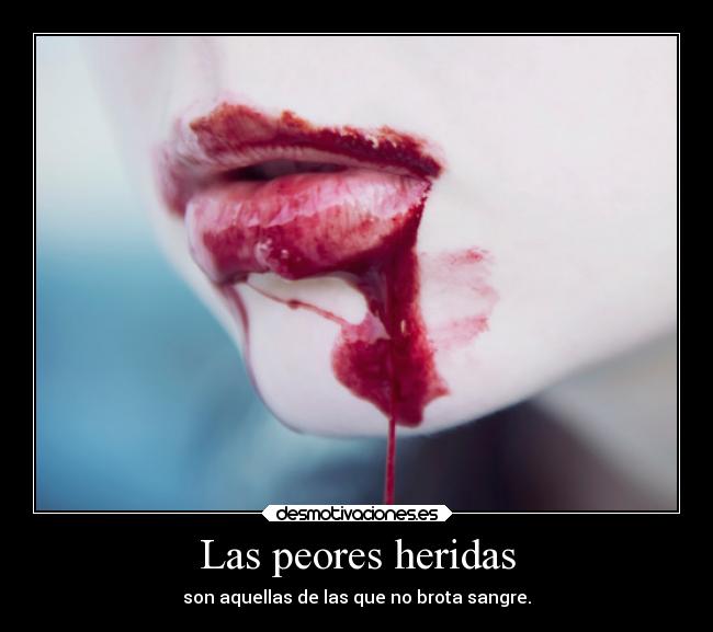 Las peores heridas - 