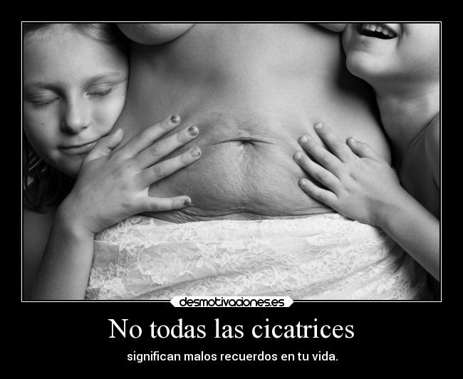 No todas las cicatrices -