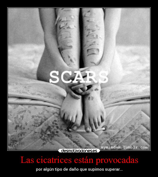 Las cicatrices están provocadas - por algún tipo de daño que supimos superar...