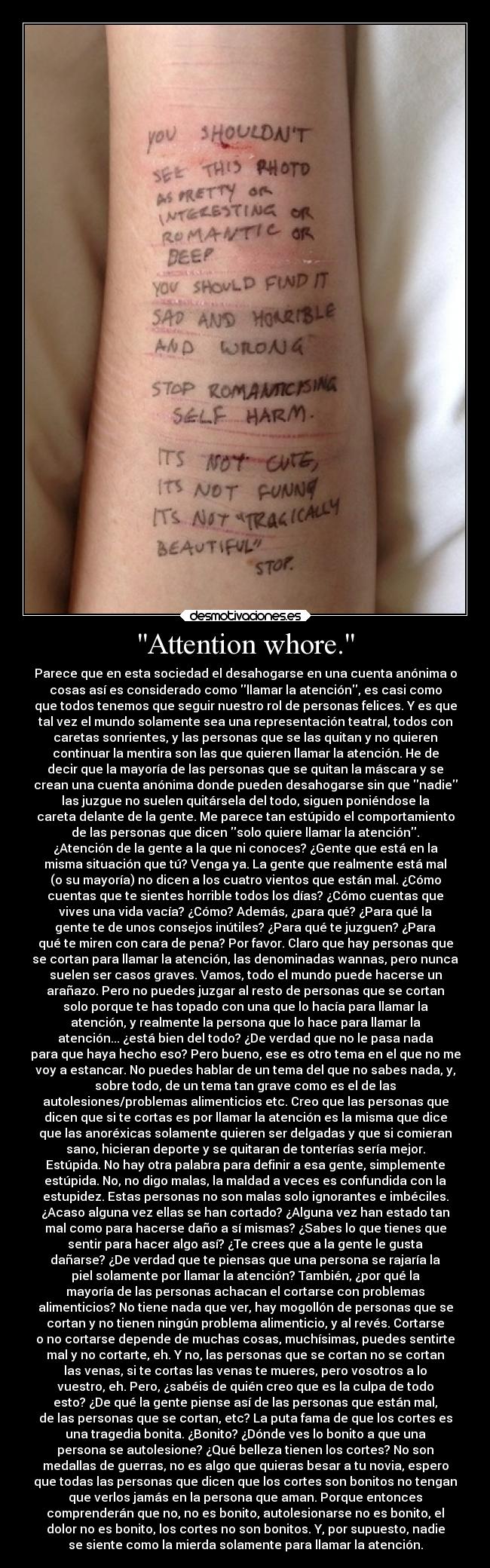 Attention whore. - Parece que en esta sociedad el desahogarse en una cuenta anónima o
cosas así es considerado como llamar la atención, es casi como
que todos tenemos que seguir nuestro rol de personas felices. Y es que
tal vez el mundo solamente sea una representación teatral, todos con
caretas sonrientes, y las personas que se las quitan y no quieren
continuar la mentira son las que quieren llamar la atención. He de
decir que la mayoría de las personas que se quitan la máscara y se
crean una cuenta anónima donde pueden desahogarse sin que nadie
las juzgue no suelen quitársela del todo, siguen poniéndose la
careta delante de la gente. Me parece tan estúpido el comportamiento
de las personas que dicen solo quiere llamar la atención.
¿Atención de la gente a la que ni conoces? ¿Gente que está en la
misma situación que tú? Venga ya. La gente que realmente está mal
(o su mayoría) no dicen a los cuatro vientos que están mal. ¿Cómo
cuentas que te sientes horrible todos los días? ¿Cómo cuentas que
vives una vida vacía? ¿Cómo? Además, ¿para qué? ¿Para qué la
gente te de unos consejos inútiles? ¿Para qué te juzguen? ¿Para
qué te miren con cara de pena? Por favor. Claro que hay personas que
se cortan para llamar la atención, las denominadas wannas, pero nunca
suelen ser casos graves. Vamos, todo el mundo puede hacerse un
arañazo. Pero no puedes juzgar al resto de personas que se cortan
solo porque te has topado con una que lo hacía para llamar la
atención, y realmente la persona que lo hace para llamar la
atención... ¿está bien del todo? ¿De verdad que no le pasa nada
para que haya hecho eso? Pero bueno, ese es otro tema en el que no me
voy a estancar. No puedes hablar de un tema del que no sabes nada, y,
sobre todo, de un tema tan grave como es el de las
autolesiones/problemas alimenticios etc. Creo que las personas que
dicen que si te cortas es por llamar la atención es la misma que dice
que las anoréxicas solamente quieren ser delgadas y que si comieran
sano, hicieran deporte y se quitaran de tonterías sería mejor.
Estúpida. No hay otra palabra para definir a esa gente, simplemente
estúpida. No, no digo malas, la maldad a veces es confundida con la
estupidez. Estas personas no son malas solo ignorantes e imbéciles.
¿Acaso alguna vez ellas se han cortado? ¿Alguna vez han estado tan
mal como para hacerse daño a sí mismas? ¿Sabes lo que tienes que
sentir para hacer algo así? ¿Te crees que a la gente le gusta
dañarse? ¿De verdad que te piensas que una persona se rajaría la
piel solamente por llamar la atención? También, ¿por qué la
mayoría de las personas achacan el cortarse con problemas
alimenticios? No tiene nada que ver, hay mogollón de personas que se
cortan y no tienen ningún problema alimenticio, y al revés. Cortarse
o no cortarse depende de muchas cosas, muchísimas, puedes sentirte
mal y no cortarte, eh. Y no, las personas que se cortan no se cortan
las venas, si te cortas las venas te mueres, pero vosotros a lo
vuestro, eh. Pero, ¿sabéis de quién creo que es la culpa de todo
esto? ¿De qué la gente piense así de las personas que están mal,
de las personas que se cortan, etc? La puta fama de que los cortes es
una tragedia bonita. ¿Bonito? ¿Dónde ves lo bonito a que una
persona se autolesione? ¿Qué belleza tienen los cortes? No son
medallas de guerras, no es algo que quieras besar a tu novia, espero
que todas las personas que dicen que los cortes son bonitos no tengan
que verlos jamás en la persona que aman. Porque entonces
comprenderán que no, no es bonito, autolesionarse no es bonito, el
dolor no es bonito, los cortes no son bonitos. Y, por supuesto, nadie
se siente como la mierda solamente para llamar la atención.