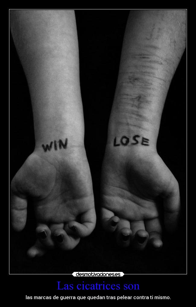 Las cicatrices son - las marcas de guerra que quedan tras pelear contra ti mismo.