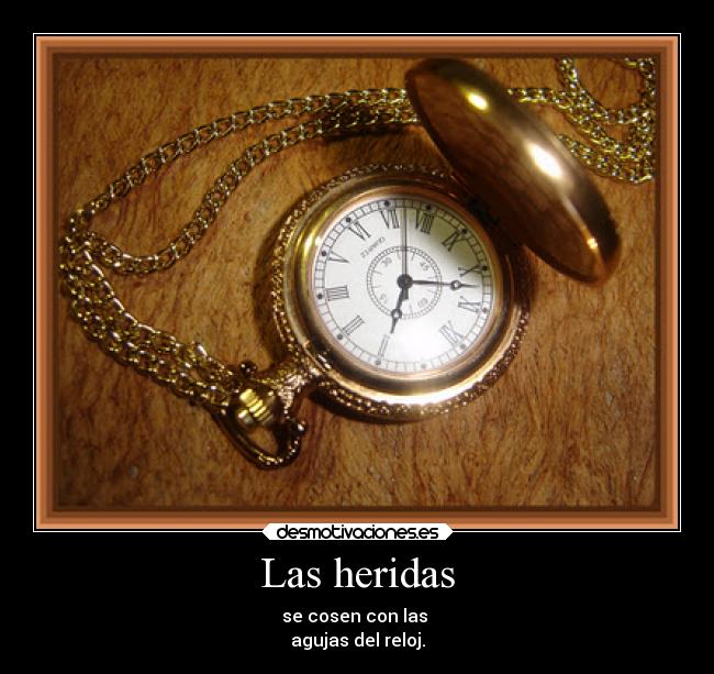 Las heridas - se cosen con las
agujas del reloj.