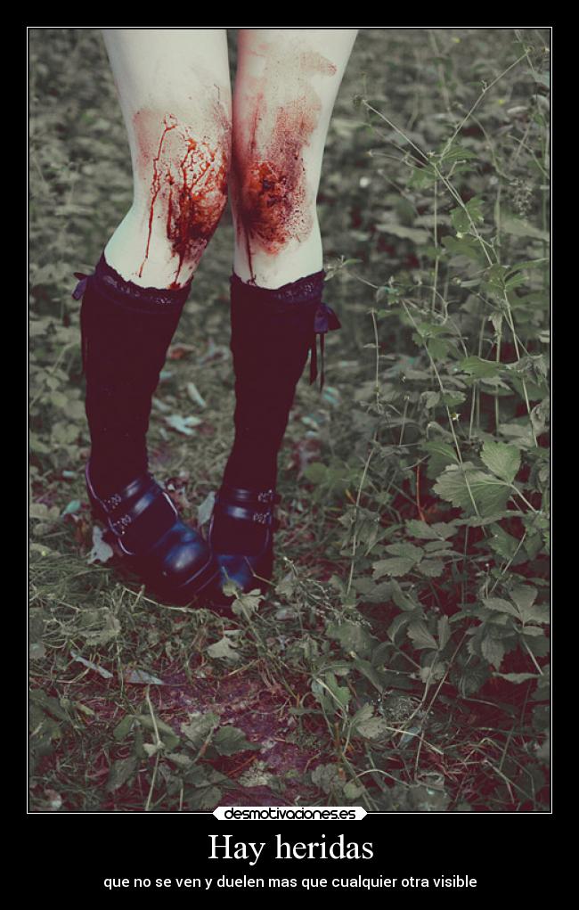 Hay heridas -