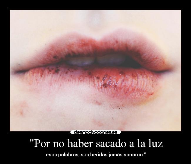 Por no haber sacado a la luz - 
