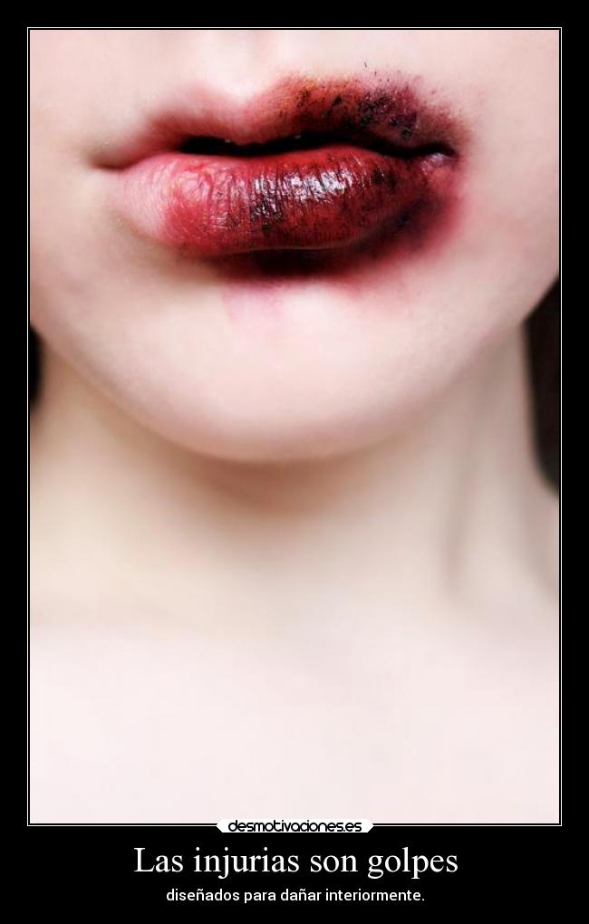 Las injurias son golpes - 