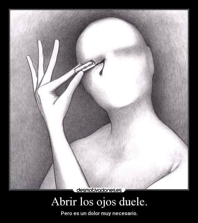 Abrir los ojos duele. - 