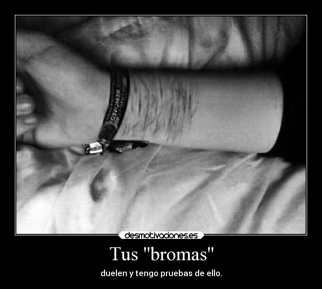 Tus bromas - duelen y tengo pruebas de ello.