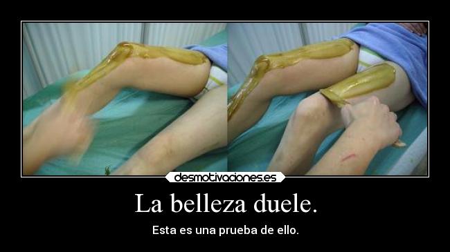 La belleza duele. - Esta es una prueba de ello.
