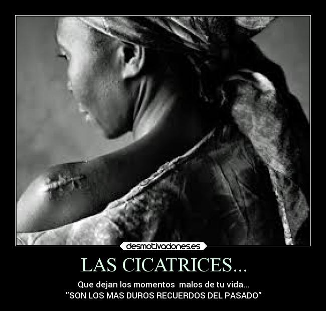 LAS CICATRICES... - Que dejan los momentos malos de tu vida...
SON LOS MAS DUROS RECUERDOS DEL PASADO