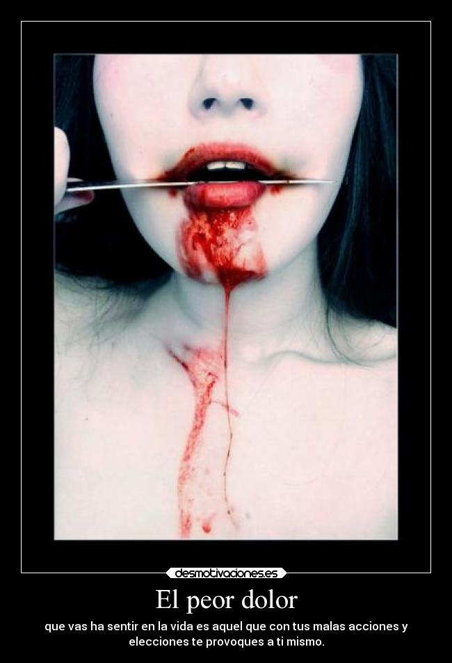 El peor dolor - 