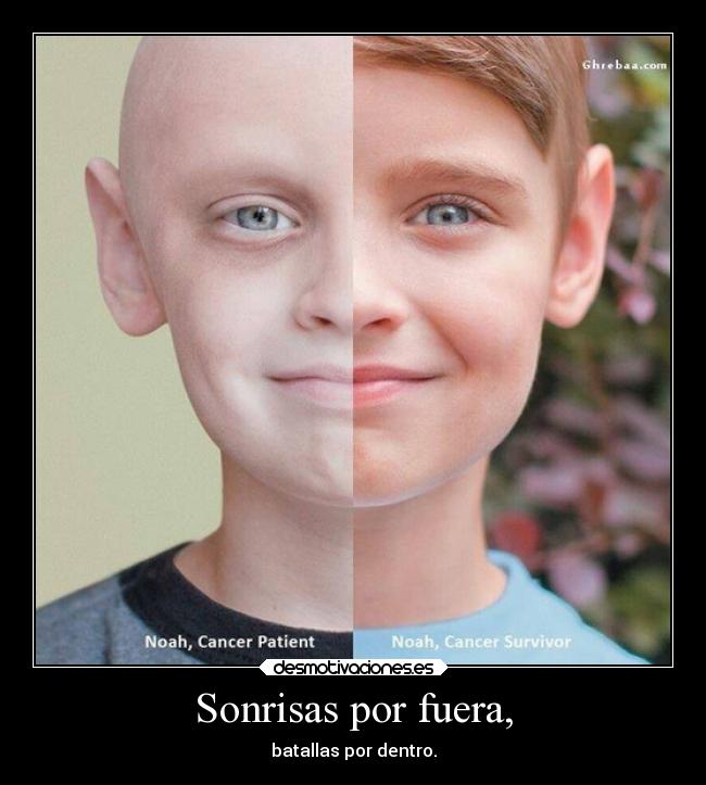 Sonrisas por fuera, - 