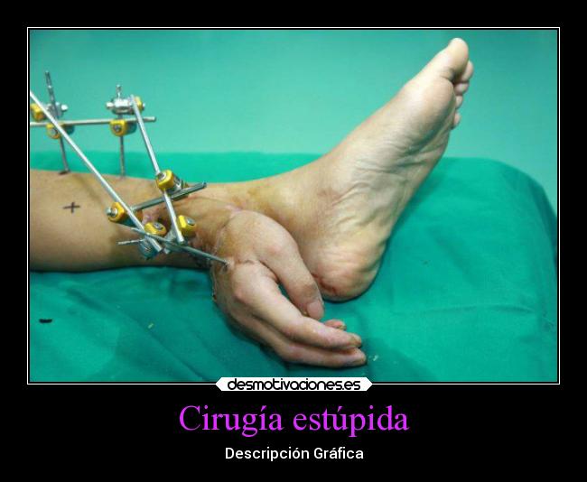 Cirugía estúpida -