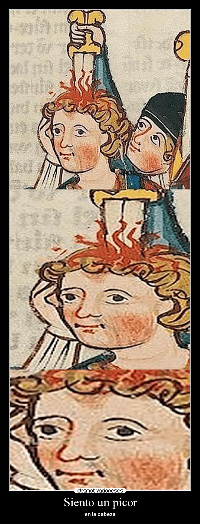 Siento un picor - 