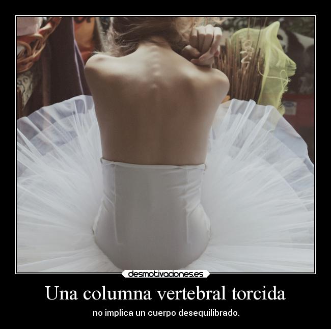 Una columna vertebral torcida -