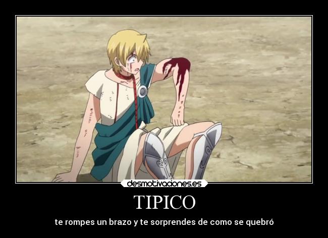 TIPICO - te rompes un brazo y te sorprendes de como se quebró