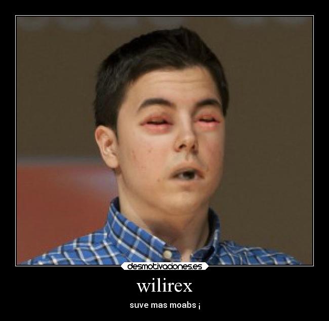 wilirex - suve mas moabs ¡