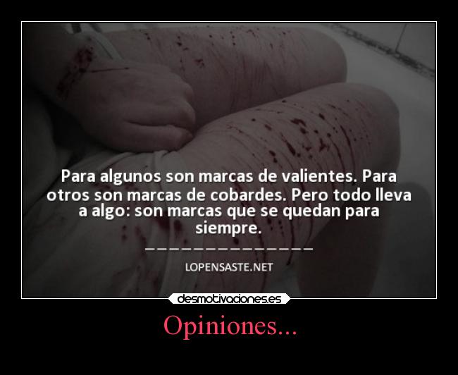 Opiniones... -