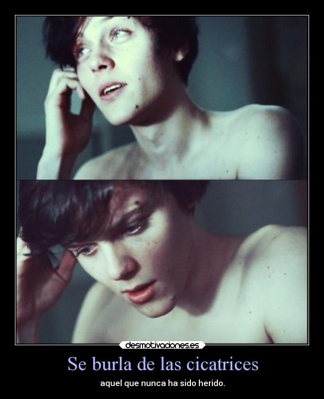 Se burla de las cicatrices - 