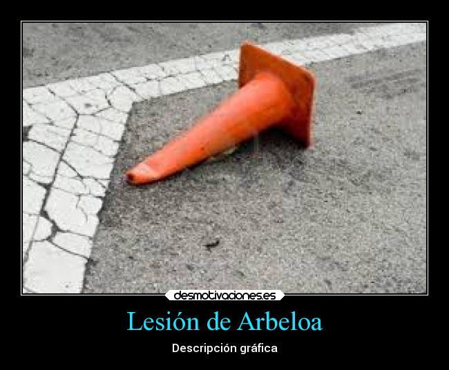 Lesión de Arbeloa - Descripción gráfica