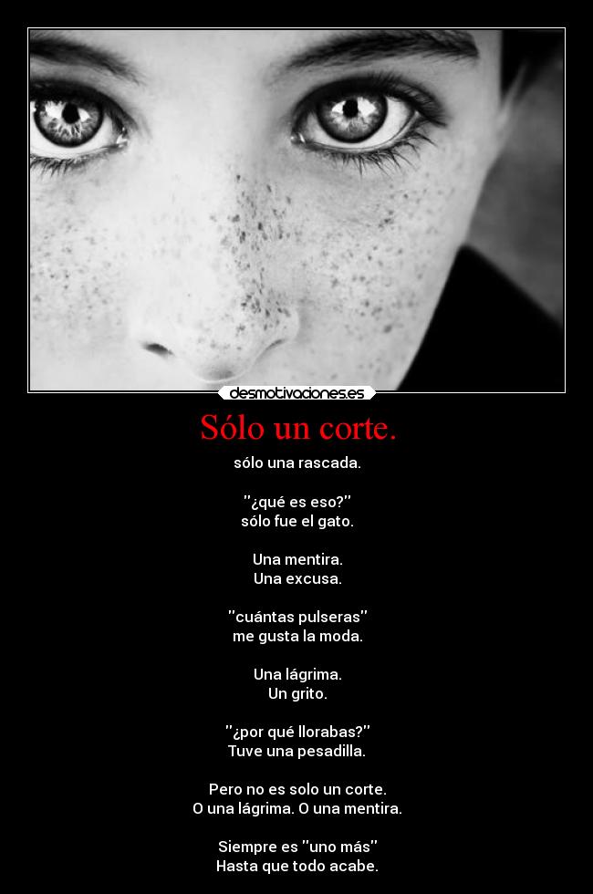 Sólo un corte. - sólo una rascada.
¿qué es eso?
sólo fue el gato.
Una mentira.
Una excusa.
cuántas pulseras
me gusta la moda.
Una lágrima.
Un grito.
¿por qué llorabas?
Tuve una pesadilla.
Pero no es solo un corte.
O una lágrima. O una mentira.
Siempre es uno más
Hasta que todo acabe.