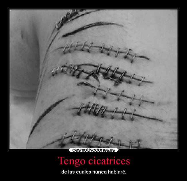 Tengo cicatrices -