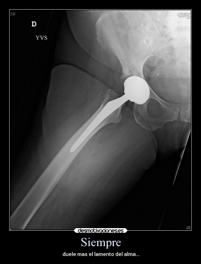 Siempre - duele mas el lamento del alma...