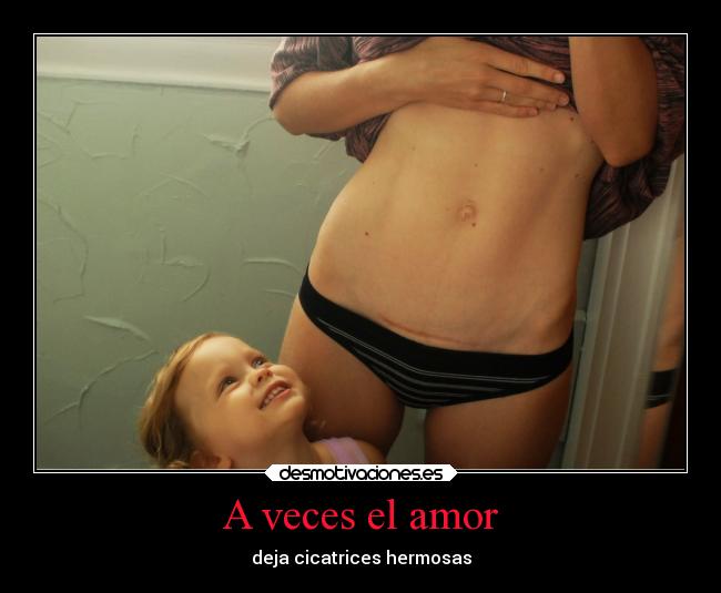 A veces el amor -