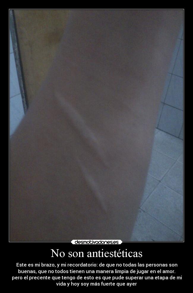 No son antiestéticas - 