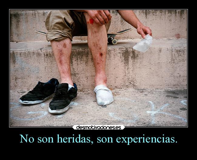 No son heridas, son experiencias. - 