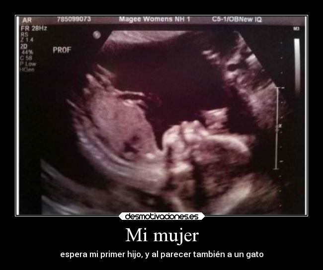 Mi mujer - espera mi primer hijo, y al parecer también a un gato
