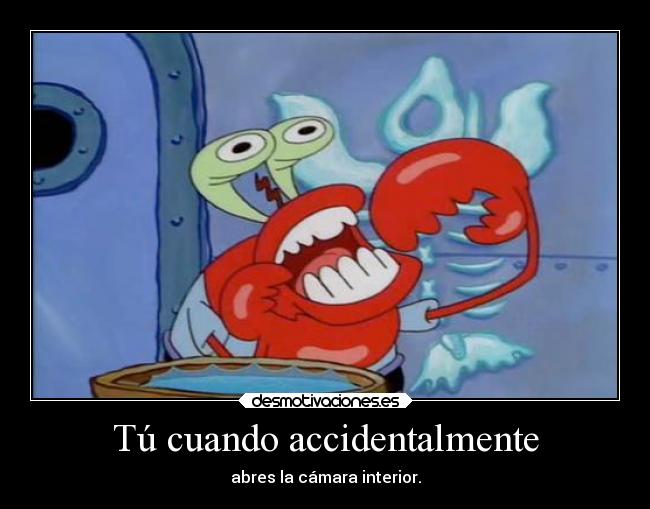 Tú cuando accidentalmente -