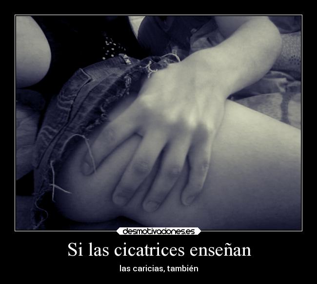 Si las cicatrices enseñan - 