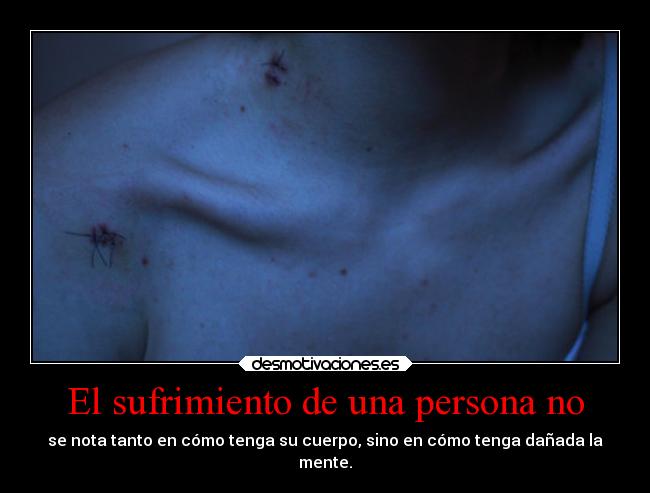 El sufrimiento de una persona no -