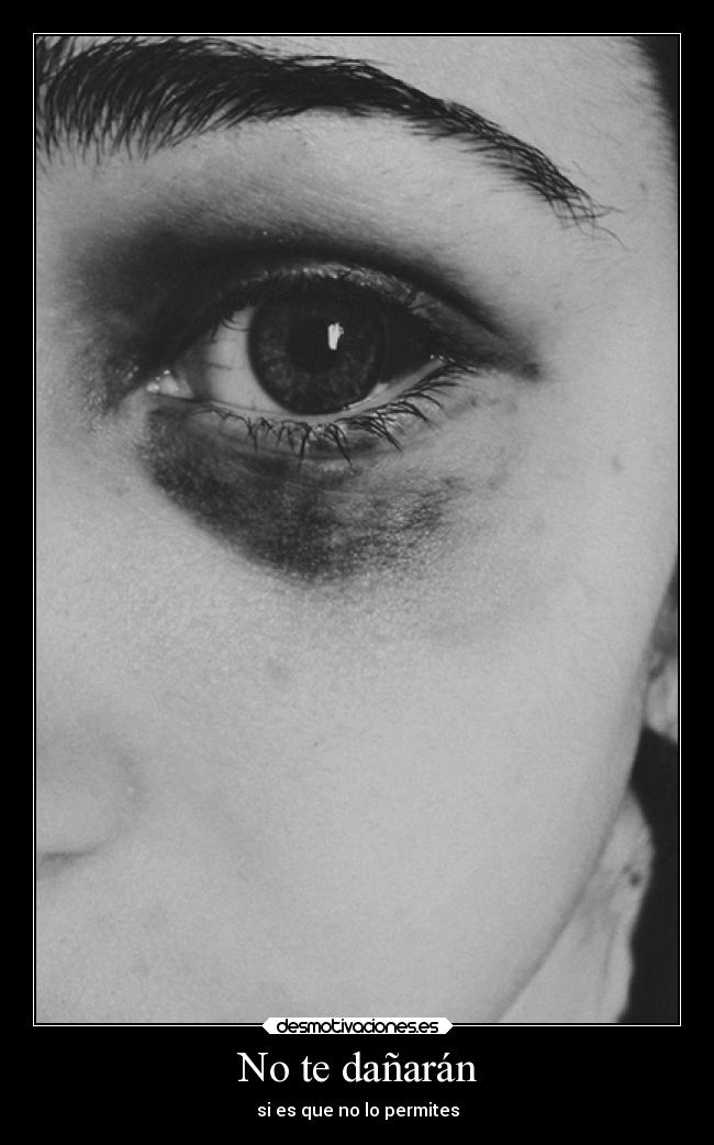 carteles dolor heridas myblackandwhiteworld carolf27 xperfectweaponx pain somewheredarker talkingthesameshit desmotivaciones