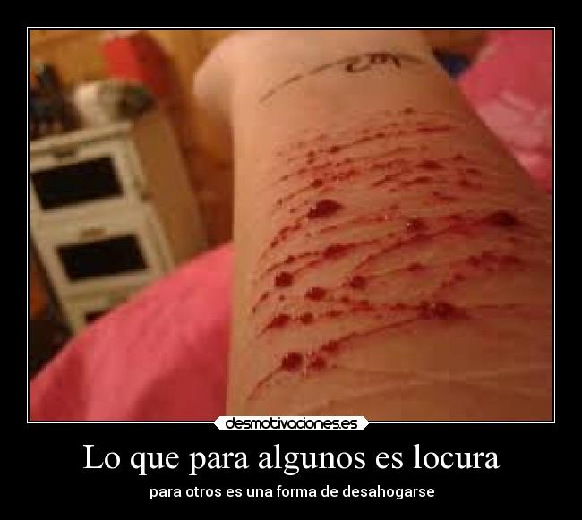 Lo que para algunos es locura - 