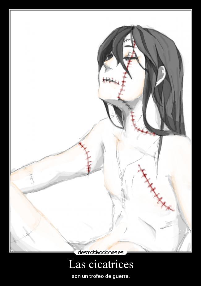 Las cicatrices -