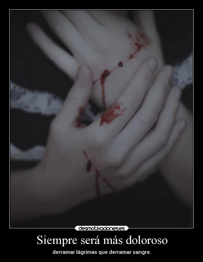Siempre será más doloroso - 