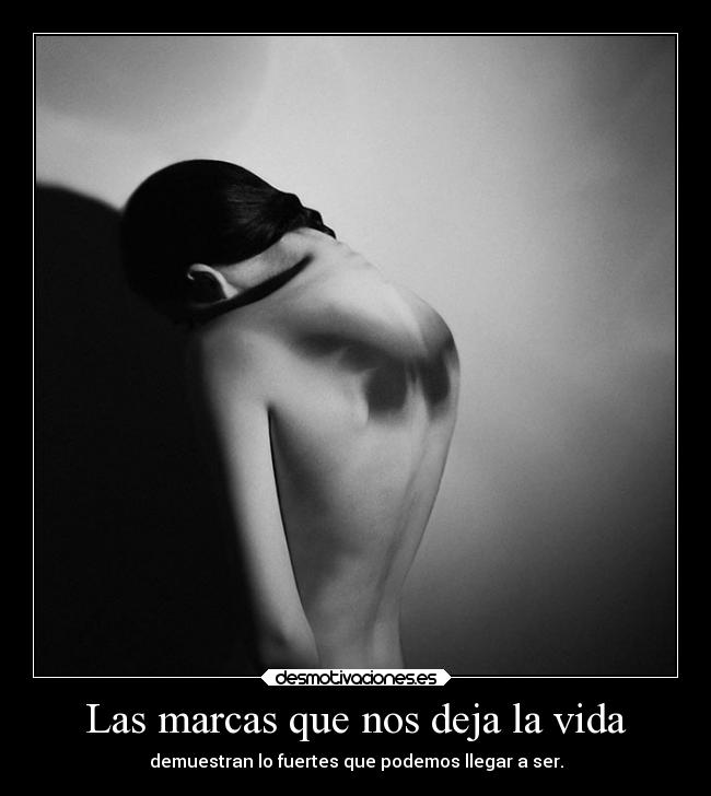 Las marcas que nos deja la vida -