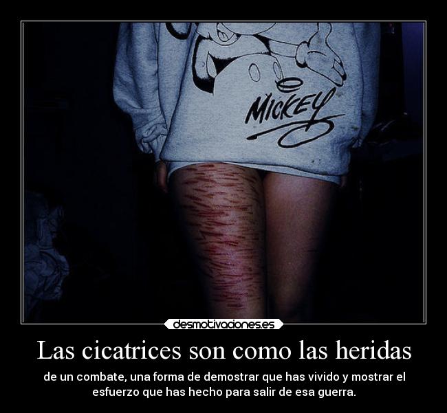 Las cicatrices son como las heridas -