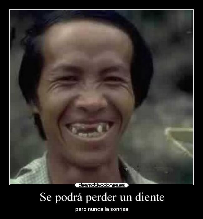 Se podrá perder un diente - pero nunca la sonrisa