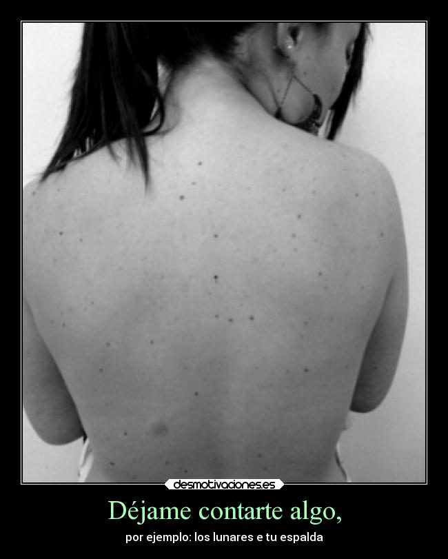 carteles amor love lunares espalda desmotivaciones