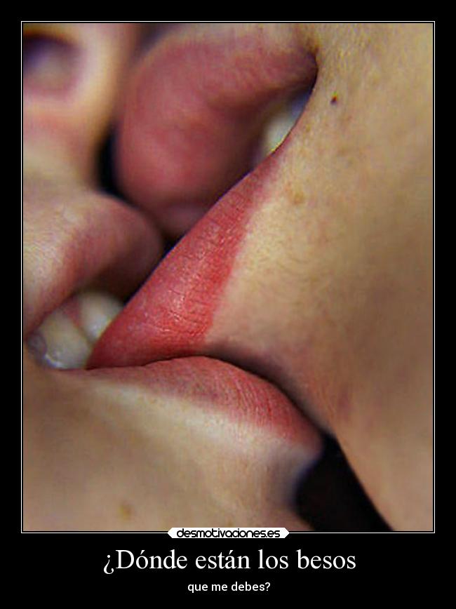 ¿Dónde están los besos -