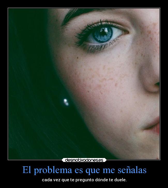 El problema es que me señalas - cada vez que te pregunto dónde te duele.