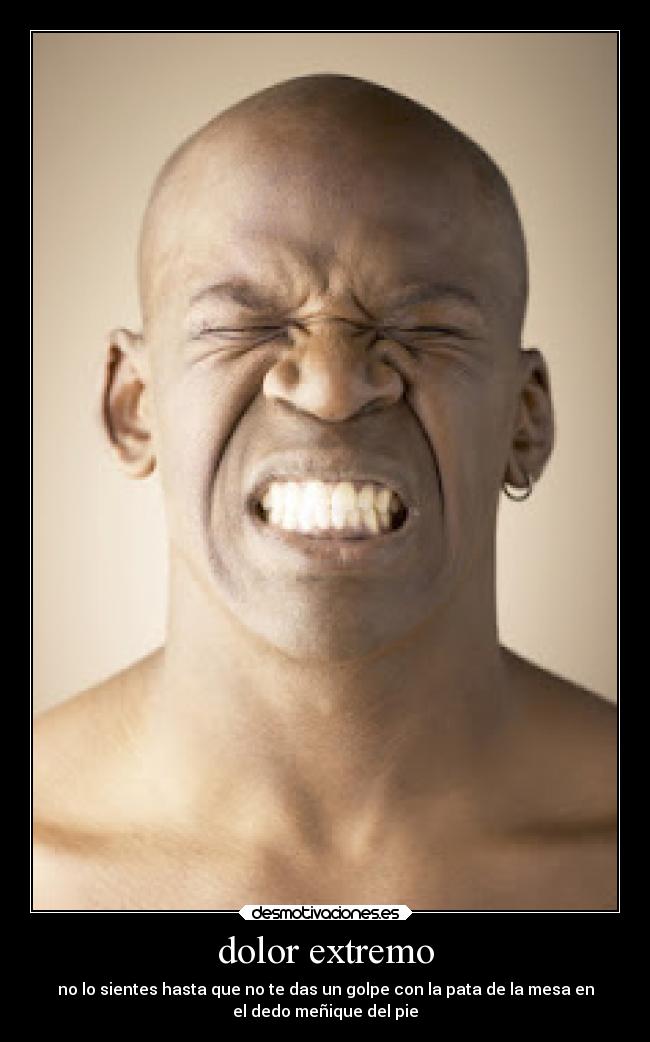 dolor extremo - no lo sientes hasta que no te das un golpe con la pata de la mesa en
el dedo meñique del pie