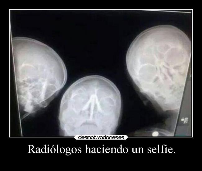 Radiólogos haciendo un selfie. - 